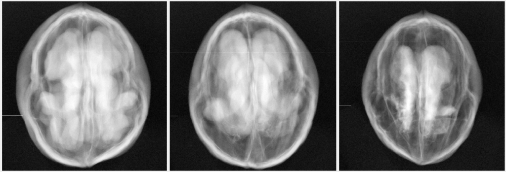 x-ray-sorting-walnuts-2